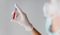 Ilustrasi tes HIV. (Foto: freepik)